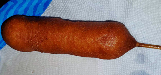 Corn Dogs